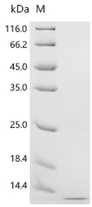 Recombinant Human Kidney-associated antigen 1(KAAG1) (CSB-YP871385HU) Recombinant Human Kidney-associated antigen 1(KAAG1) (CSB-YP871385HU)