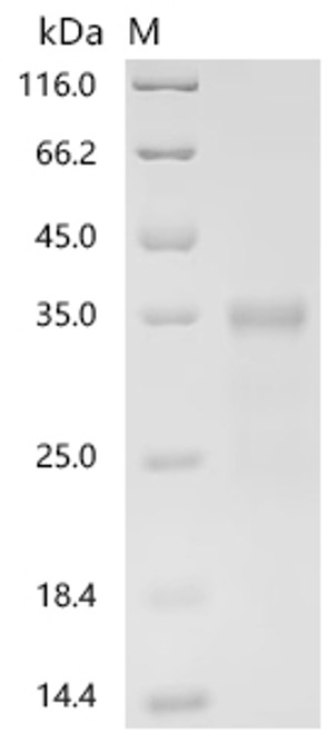 Recombinant Human Signal transducer CD24 (CD24), partial (CSB-YP004902HU) Recombinant Human Signal transducer CD24 (CD24), partial (CSB-YP004902HU)