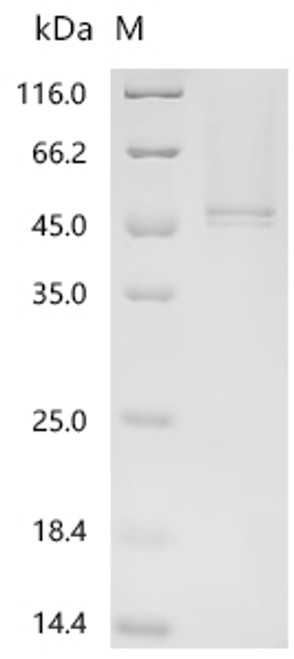 Recombinant Human Cathepsin D (CTSD) (CSB-YP006187HU(A4))