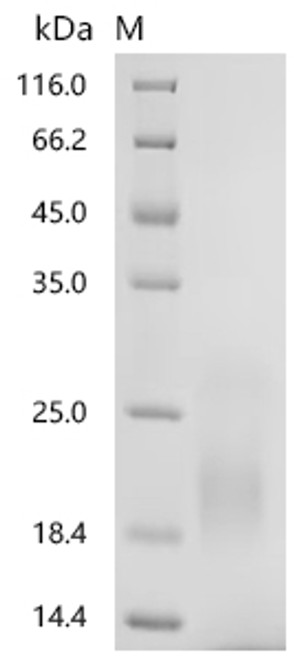 Recombinant Human CMRF35-like molecule 5 (CD300LD), partial (CSB-YP757797HU1) Recombinant Human CMRF35-like molecule 5 (CD300LD), partial (CSB-YP757797HU1)
