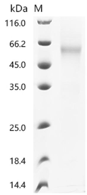 Recombinant Human Dipeptidase 2 (DPEP2) (CSB-YP007124HUd7) Recombinant Human Dipeptidase 2 (DPEP2) (CSB-YP007124HUd7)