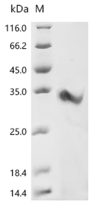 Recombinant Mouse CMRF35-like molecule 5 (Cd300ld), partial (CSB-YP840832MO) Recombinant Mouse CMRF35-like molecule 5 (Cd300ld), partial (CSB-YP840832MO)