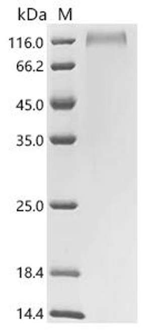 Recombinant Human Integrin beta-6 (ITGB6), partial (CSB-YP011890HU1) Recombinant Human Integrin beta-6 (ITGB6), partial (CSB-YP011890HU1)
