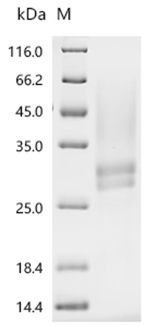 Recombinant Human Low affinity immunoglobulin gamma Fc region receptor II-a (FCGR2A), partial (CSB-YP008540HU1) Recombinant Human Low affinity immunoglobulin gamma Fc region receptor II-a (FCGR2A), partial (CSB-YP008540HU1)