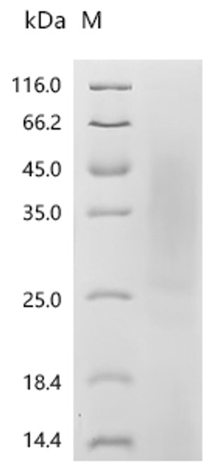 Recombinant Human Tumor necrosis factor ligand superfamily member 15(TNFSF15) (CSB-YP023992HU(F2)) Recombinant Human Tumor necrosis factor ligand superfamily member 15(TNFSF15) (CSB-YP023992HU(F2))