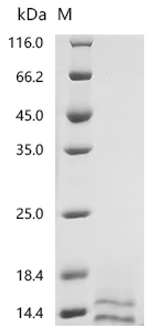 Recombinant Pig Fibroblast growth factor (FGF2), Partial (CSB-YP008625PI) Recombinant Pig Fibroblast growth factor (FGF2), Partial (CSB-YP008625PI)