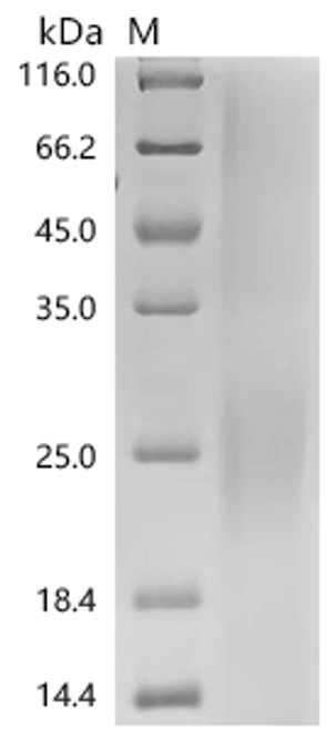 Recombinant Mouse Interleukin-3 (Il3) (CSB-YP011652MOa0) Recombinant Mouse Interleukin-3 (Il3) (CSB-YP011652MOa0)