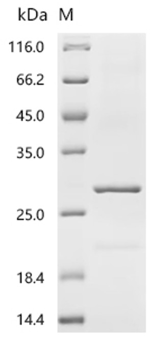Recombinant Human cytomegalovirus Enhanced green fluorescent protein (egfp) (CSB-YP2069HIZp4) Recombinant Human cytomegalovirus Enhanced green fluorescent protein (egfp) (CSB-YP2069HIZp4)