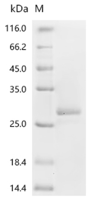 Recombinant Mouse Gamma-interferon-inducible lysosomal thiol reductase (Ifi30) (CSB-YP872152MO) Recombinant Mouse Gamma-interferon-inducible lysosomal thiol reductase (Ifi30) (CSB-YP872152MO)