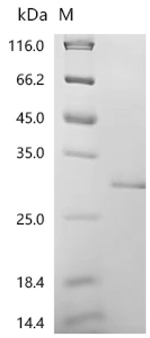 Recombinant Mouse Aquaporin-7 (Aqp7), partial (CSB-YP001967MO1f5) Recombinant Mouse Aquaporin-7 (Aqp7), partial (CSB-YP001967MO1f5)