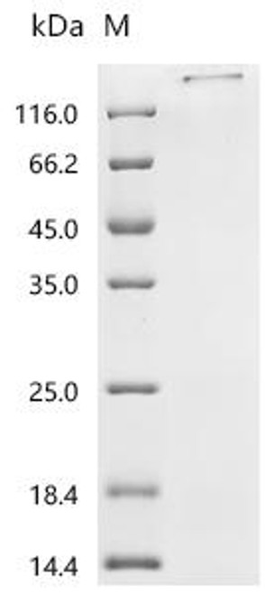 Recombinant Human Transmembrane protein 106B (TMEM106B), partial (CSB-YP023674HU3) Recombinant Human Transmembrane protein 106B (TMEM106B), partial (CSB-YP023674HU3)