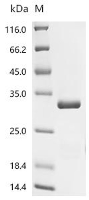 Recombinant Danio rerio Fatty acid-binding protein 10-A, liver basic (fabp10a) (CSB-YP881243DIL) Recombinant Danio rerio Fatty acid-binding protein 10-A, liver basic (fabp10a) (CSB-YP881243DIL)