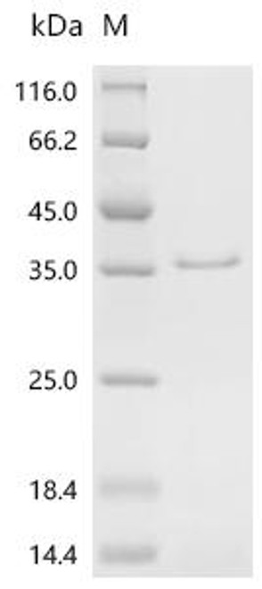 Recombinant Saccharomyces cerevisiae Meiotic recombination protein DMC1 (DMC1) (CSB-YP338672SVG) Recombinant Saccharomyces cerevisiae Meiotic recombination protein DMC1 (DMC1) (CSB-YP338672SVG)