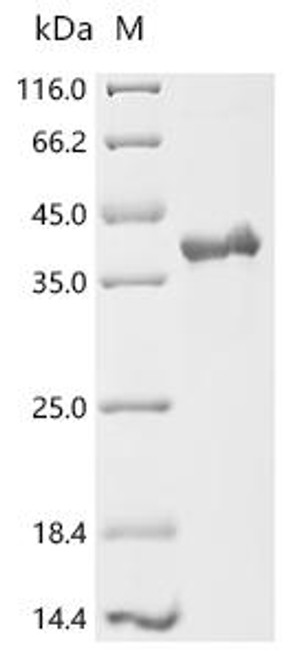 Recombinant Spinacia oleracea Phosphoribulokinase, chloroplastic (CSB-YP362728FKI) Recombinant Spinacia oleracea Phosphoribulokinase, chloroplastic (CSB-YP362728FKI)
