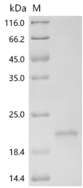 Recombinant Mouse Transcription factor MafF (Maff) (CSB-YP013318MOa4) Recombinant Mouse Transcription factor MafF (Maff) (CSB-YP013318MOa4)