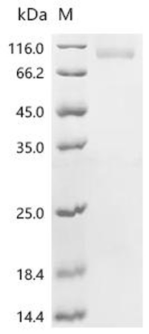 Recombinant Human Transcription factor EB (TFEB) (CSB-YP023429HU) Recombinant Human Transcription factor EB (TFEB) (CSB-YP023429HU)