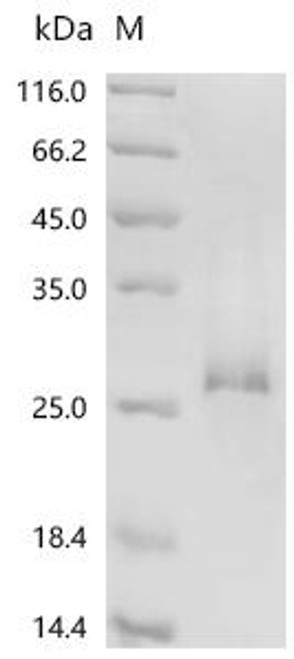 Recombinant Pig Interleukin-2 receptor subunit alpha (IL2RA), partial (CSB-YP011649PI1)