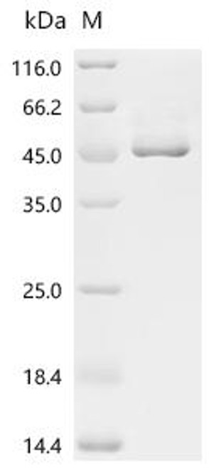 Recombinant Coccidioides immitis Endochitinase 1 (CTS1) (CSB-YP627763DUV) Recombinant Coccidioides immitis Endochitinase 1 (CTS1) (CSB-YP627763DUV)