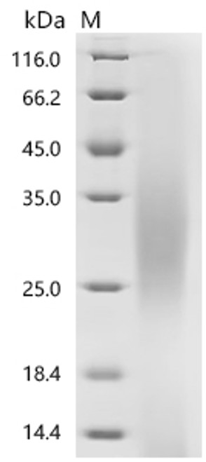 Recombinant Human Neutral amino acid transporter 9 (SLC38A9),partial (CSB-YP836713HU) Recombinant Human Neutral amino acid transporter 9 (SLC38A9),partial (CSB-YP836713HU)