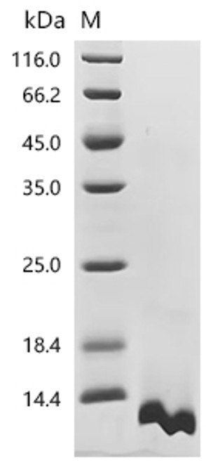 Recombinant Bovine Regakine-1 (CSB-YP307300BO) Recombinant Bovine Regakine-1 (CSB-YP307300BO)