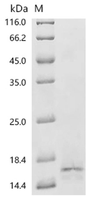 Recombinant Human Bromodomain-containing protein 2 (BRD2), partial (CSB-YP002800HUp3)