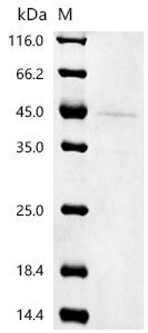 Recombinant Mouse Neurogenic differentiation factor 1 (Neurod1)(M114A,H115A) (CSB-YP720182MO(M4)) Recombinant Mouse Neurogenic differentiation factor 1 (Neurod1)(M114A,H115A) (CSB-YP720182MO(M4))