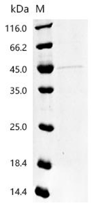 Recombinant Mouse Neurogenic differentiation factor 1 (Neurod1)(H115A) (CSB-YP720182MO(M2)) Recombinant Mouse Neurogenic differentiation factor 1 (Neurod1)(H115A) (CSB-YP720182MO(M2))