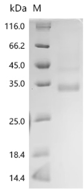 Recombinant Human Transcriptional enhancer factor TEF-5 (TEAD3), partial (CSB-YP860344HU)