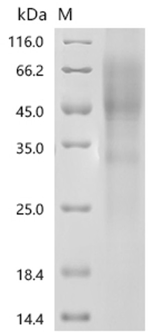 Recombinant Human Microtubule-associated protein tau (MAPT) (CSB-YP013481HU(F8)L5)