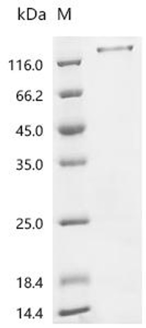 Recombinant Mouse Mucin-1 (Muc1),partial (CSB-YP312543MO)