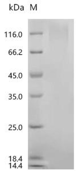 Recombinant Human Cytotoxic granule associated RNA binding protein TIA1 (TIA1) (CSB-YP023527HU)