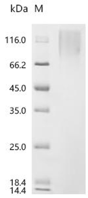 Recombinant Human Delta and Notch-like epidermal growth factor-related receptor (DNER), partial (CSB-YP818784HU)