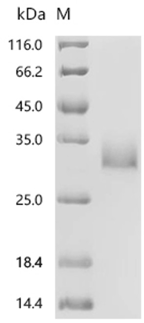 Recombinant Human Tumor necrosis factor receptor superfamily member 25 (TNFRSF25), partial (CSB-MP839000HU)