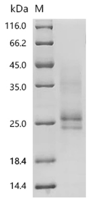 Recombinant Human Beta-nerve growth factor (NGF) (R121G) (CSB-MP015779HU(A4)(M1))