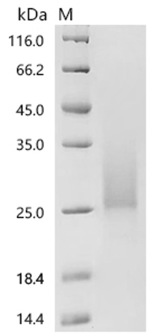 Recombinant Mouse Interleukin-3 (Il3) (CSB-MP011652MO)