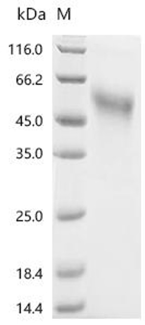 Recombinant Human Transcription factor SOX-2 (SOX2) (CSB-MP022426HU)