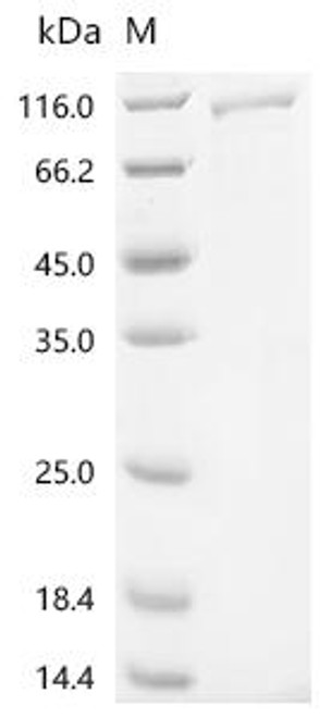 Recombinant Human Transferrin receptor protein 2 (TFR2), partial (CSB-MP891794HU)