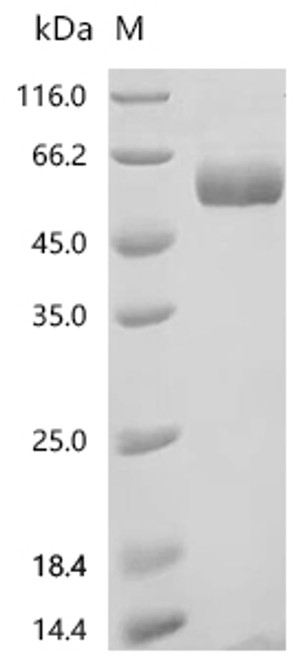 Recombinant Human Dipeptidyl peptidase 1(CTSC) (CSB-MP006186HU)
