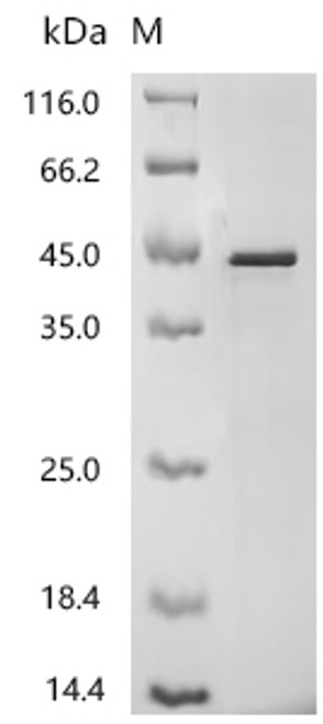 Recombinant Human Reticulocalbin-2 (RCN2) (CSB-MP621768HUd7)