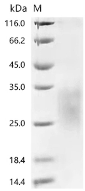Recombinant Mouse Keratin, type I cytoskeletal 18 (KRT18), partial (CSB-MP012519MOd7)