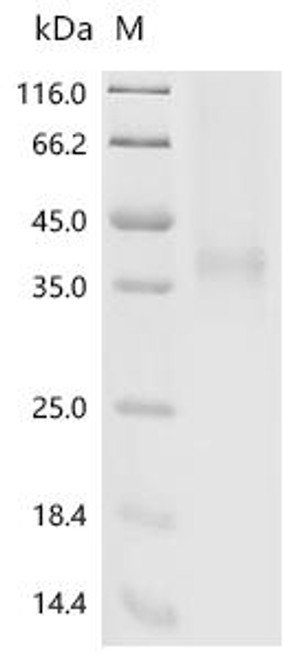 Recombinant Mouse Interleukin-34 (Il34) (CSB-MP837125MO)