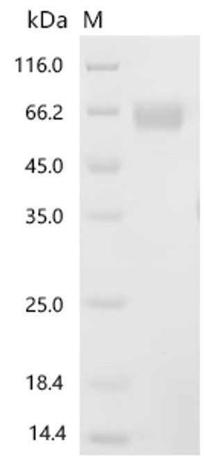 Recombinant Rat Interleukin-1 receptor accessory protein (Il1rap), partial (Active) (CSB-MP733954RA) Recombinant Rat Interleukin-1 receptor accessory protein (Il1rap), partial (Active) (CSB-MP733954RA)