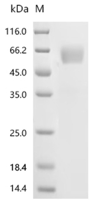 Recombinant Mouse Interleukin-1 receptor accessory protein (Il1rap), partial (Active) (CSB-MP730751MO) Recombinant Mouse Interleukin-1 receptor accessory protein (Il1rap), partial (Active) (CSB-MP730751MO)
