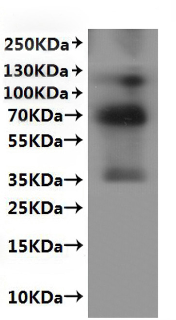 Recombinant Mouse G-protein coupled receptor 20 (Gpr20)-VLPs (CSB-MP806933MO) Recombinant Mouse G-protein coupled receptor 20 (Gpr20)-VLPs (CSB-MP806933MO)