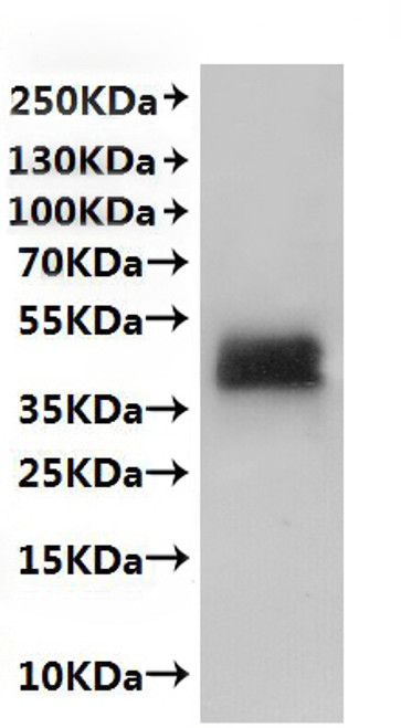 Recombinant Mouse CX3C chemokine receptor 1 (Cx3cr1)-VLPs (CSB-MP897445MO) Recombinant Mouse CX3C chemokine receptor 1 (Cx3cr1)-VLPs (CSB-MP897445MO)