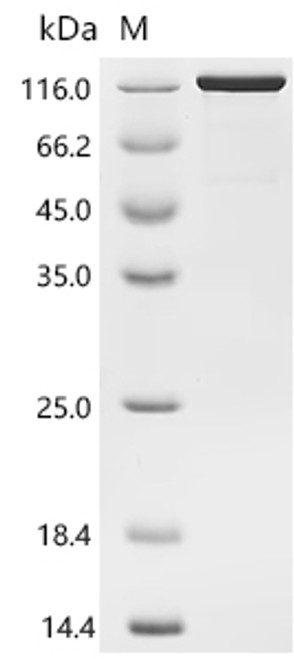 Recombinant Human Cadherin-17 (CDH17), partial (CSB-MP613267HUh8)