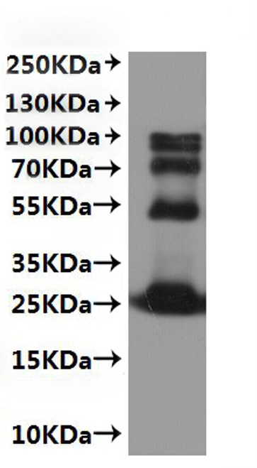 Recombinant Mouse Membrane-spanning 4-domains, subfamily A, member 4A (Ms4a4a)-VLPs (CSB-MP5518MO) Recombinant Mouse Membrane-spanning 4-domains, subfamily A, member 4A (Ms4a4a)-VLPs (CSB-MP5518MO)