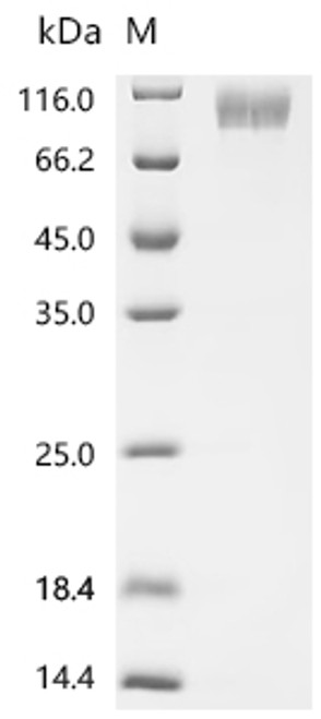 Recombinant Human Integrin beta-6 (ITGB6), partial (CSB-MP011890HU1) Recombinant Human Integrin beta-6 (ITGB6), partial (CSB-MP011890HU1)