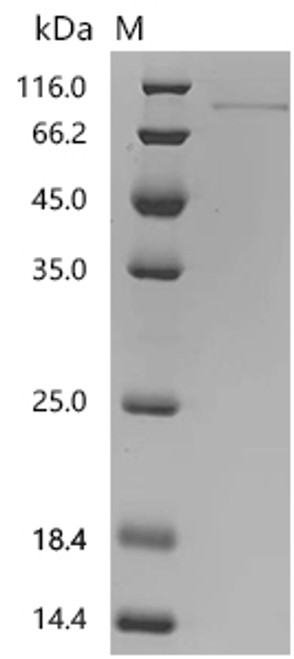 Recombinant Human Netrin-1 (NTN1), partial (CSB-MP016127HU(A4)) Recombinant Human Netrin-1 (NTN1), partial (CSB-MP016127HU(A4))