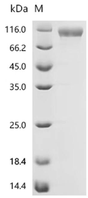 Recombinant Macaca fascicularis Integrin beta (ITGB6), partial (CSB-MP5472MOV) Recombinant Macaca fascicularis Integrin beta (ITGB6), partial (CSB-MP5472MOV)